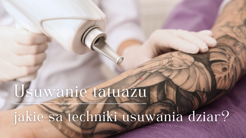 Usuwanie tatuażu – jakie są techniki usuwania dziar?