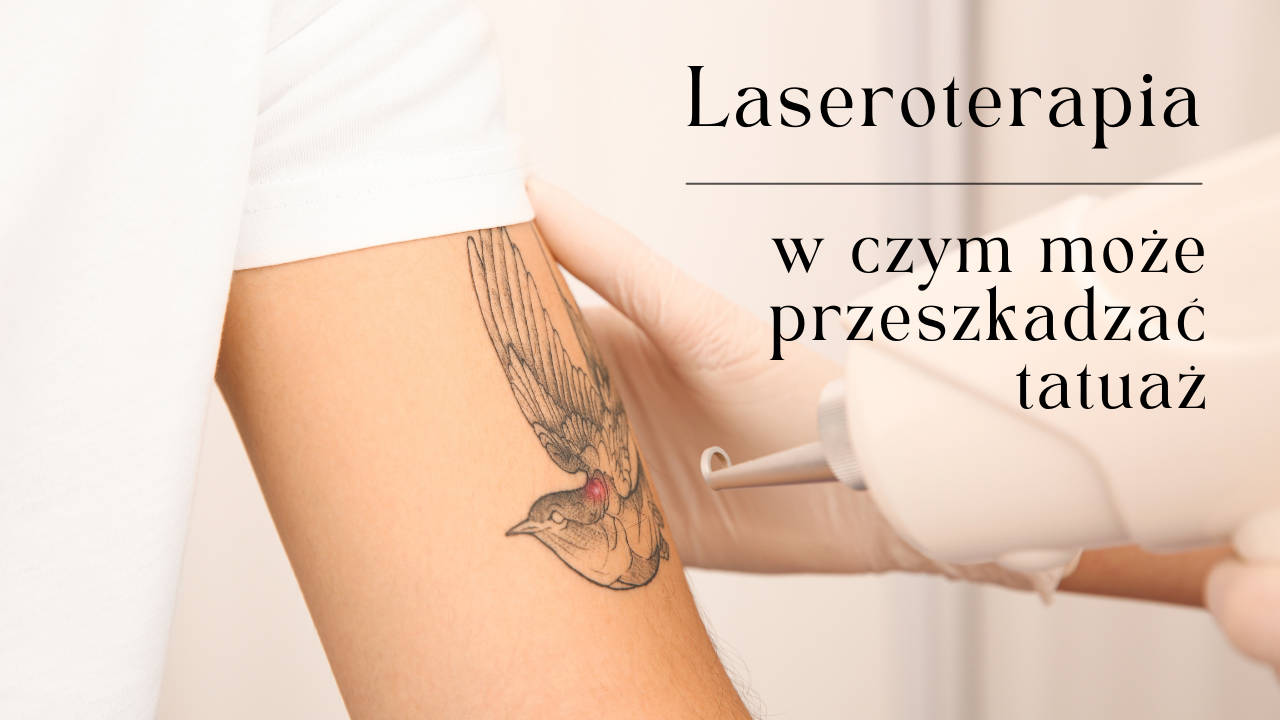 Laseroterapia – w czym może przeszkadzać tatuaż?